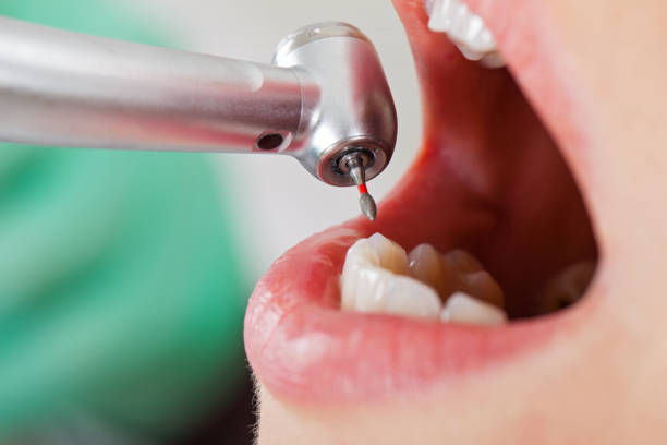 Best Emergency Wisdom Teeth Removal in Flomaton, AL